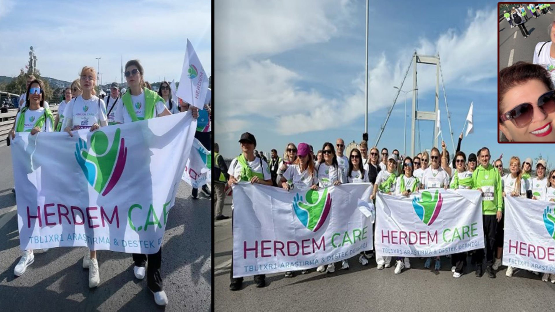 Herdem Çare Derneği, İstanbul Maratonu’nda Koştu