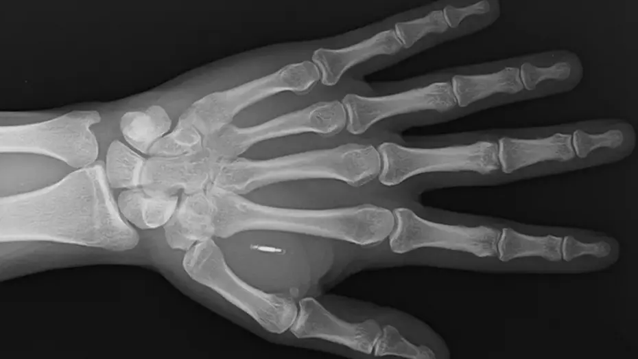 Mikroçip İmplantının Şifresini Unutan Sihirbazın Hikayesi Mikroçip İmplantının Şifresini Unutan Sihirbazın Hikayesi